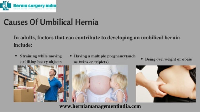 Kendra Wilkonson Porn Adult Umbilical Hernia Repair